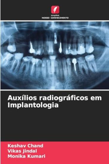 Auxílios radiográficos em Implantologia