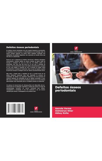 Defeitos ósseos periodontais
