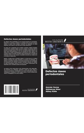 Defectos óseos periodontales