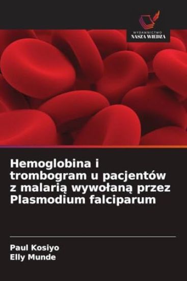 Hemoglobina i trombogram u pacjentów z malari¿ wywo¿an¿ przez Plasmodium falciparum