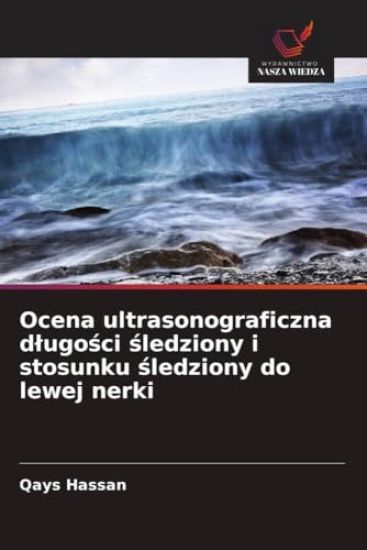 Ocena ultrasonograficzna d¿ugo¿ci ¿ledziony i stosunku ¿ledziony do lewej nerki