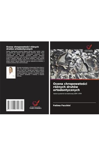 Ocena chropowato¿ci ró¿nych drutów ortodontycznych