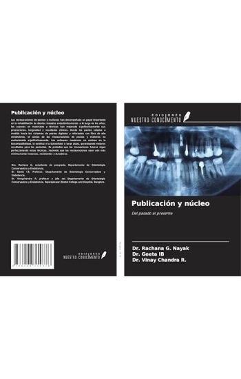 Publicación y núcleo