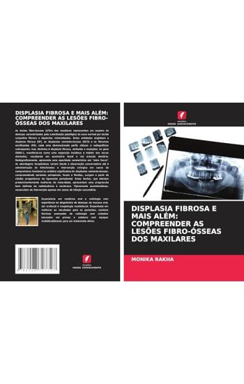 DISPLASIA FIBROSA E MAIS ALÉM: COMPREENDER AS LESÕES FIBRO-ÓSSEAS DOS MAXILARES