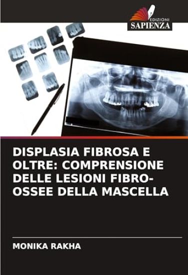 DISPLASIA FIBROSA E OLTRE: COMPRENSIONE DELLE LESIONI FIBRO-OSSEE DELLA MASCELLA