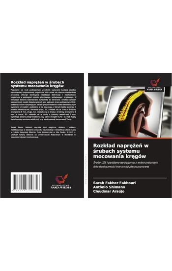 Rozk¿ad napr¿¿e¿ w ¿rubach systemu mocowania kr¿gów