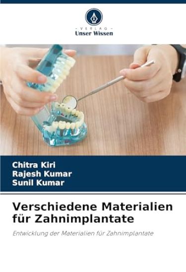 Verschiedene Materialien für Zahnimplantate
