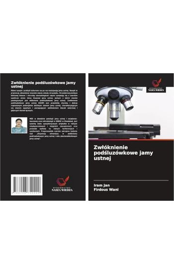 Zw¿óknienie pod¿luzówkowe jamy ustnej