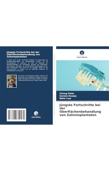 Jüngste Fortschritte bei der Oberflächenbehandlung von Zahnimplantaten