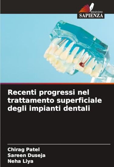 Recenti progressi nel trattamento superficiale degli impianti dentali