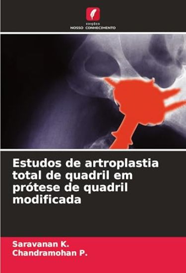 Estudos de artroplastia total de quadril em prótese de quadril modificada