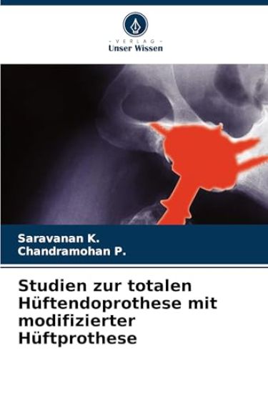Studien zur totalen Hüftendoprothese mit modifizierter Hüftprothese