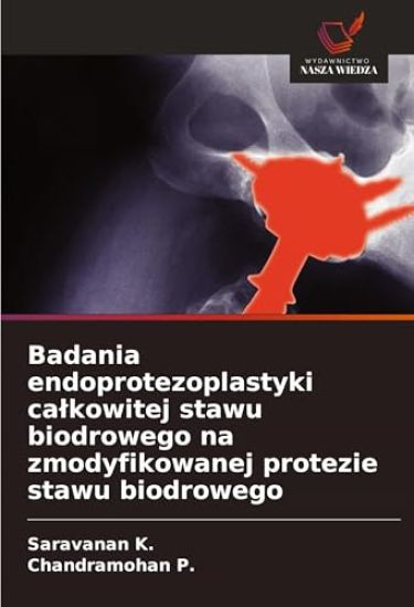 Badania endoprotezoplastyki ca¿kowitej stawu biodrowego na zmodyfikowanej protezie stawu biodrowego