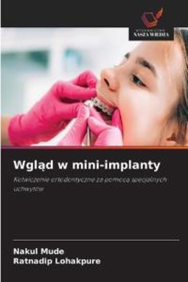 Wgl¿d w mini-implanty