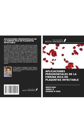 APLICACIONES PERIODONTALES DE LA FIBRINA RICA EN PLAQUETAS INYECTABLE