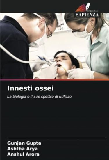 Innesti ossei