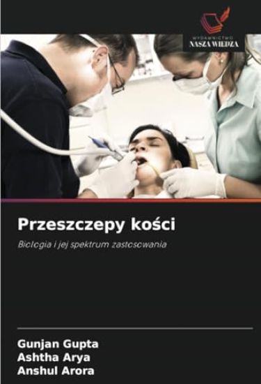 Przeszczepy kosci