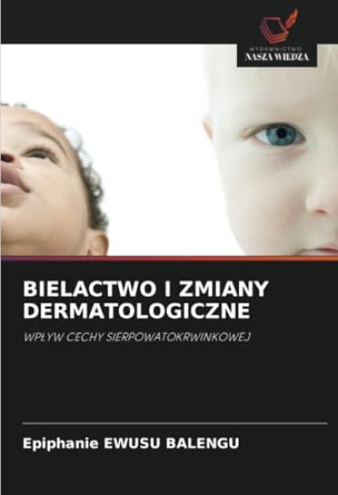 Bielactwo I Zmiany Dermatologiczne