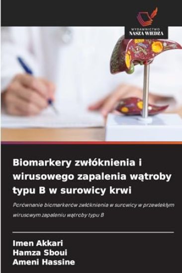 Biomarkery zwlóknienia i wirusowego zapalenia watroby typu B w surowicy krwi