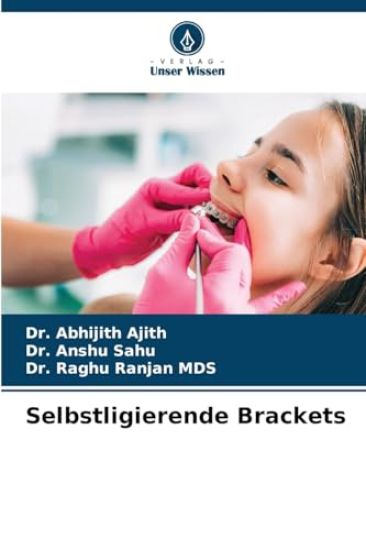 Selbstligierende Brackets