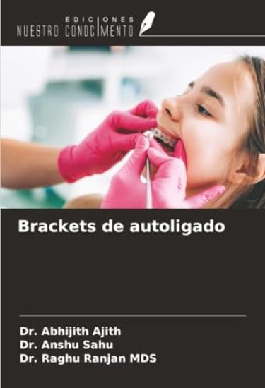 Brackets de autoligado