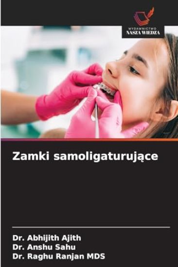 Zamki samoligaturujące