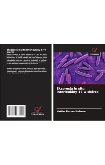 Ekspresja in situ interleukiny-17 w skórze