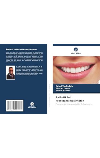 Ästhetik bei Frontzahnimplantaten