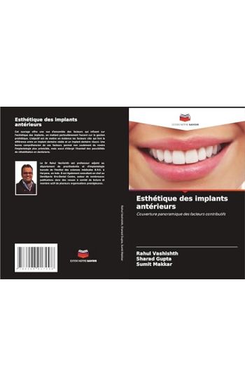 Esthétique des implants antérieurs