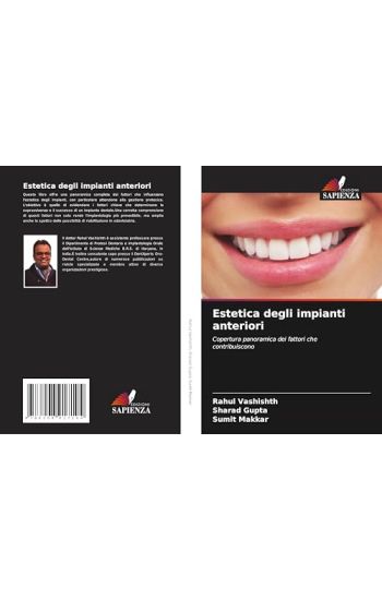 Estetica degli impianti anteriori