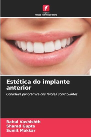 Estética do implante anterior