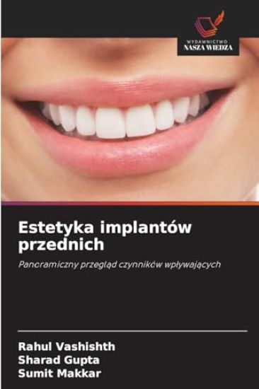 Estetyka implantów przednich