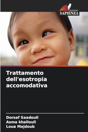 Trattamento dell'esotropia accomodativa