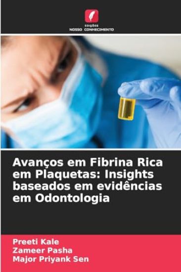 Avanços em Fibrina Rica em Plaquetas