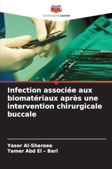 Infection associée aux biomatériaux après une intervention chirurgicale buccale