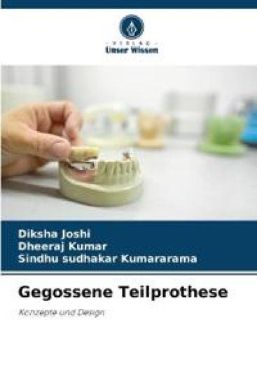 Gegossene Teilprothese