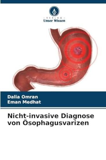 Nicht-invasive Diagnose von Ösophagusvarizen