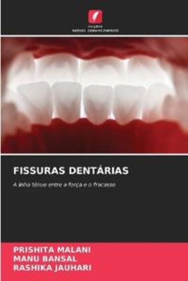 Fissuras Dentárias