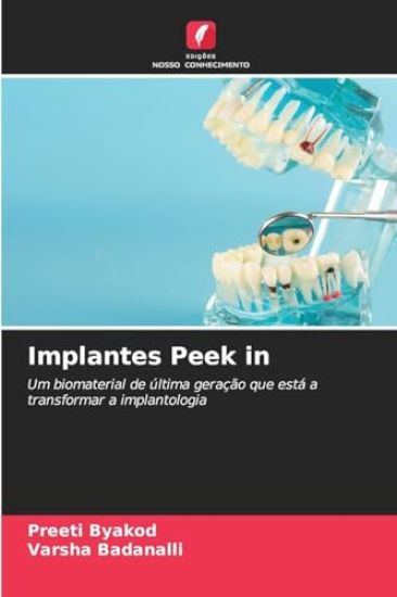Implantes Peek in