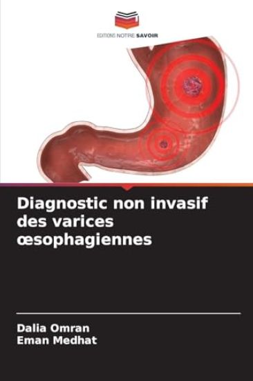 Diagnostic non invasif des varices oesophagiennes