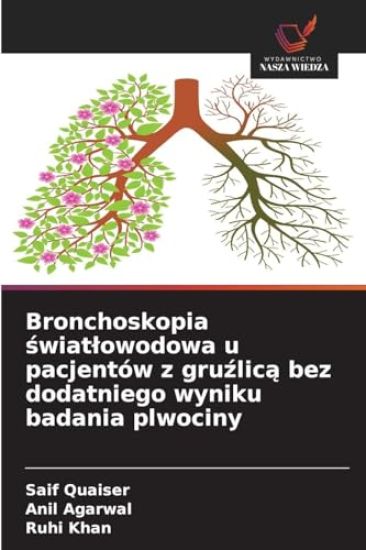 Bronchoskopia swiatlowodowa u pacjentów z gruzlica bez dodatniego wyniku badania plwociny