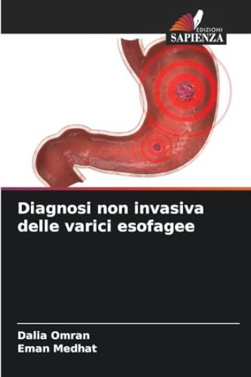 Diagnosi non invasiva delle varici esofagee
