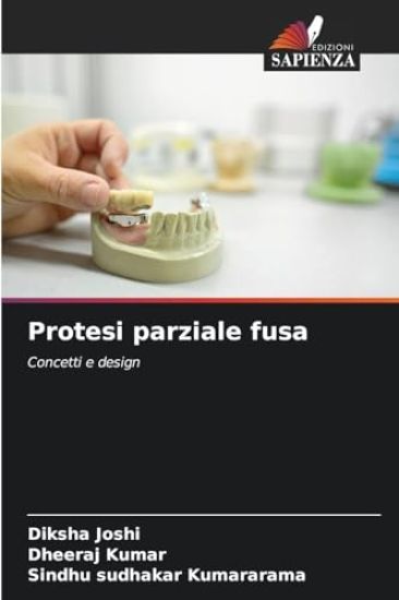Protesi parziale fusa