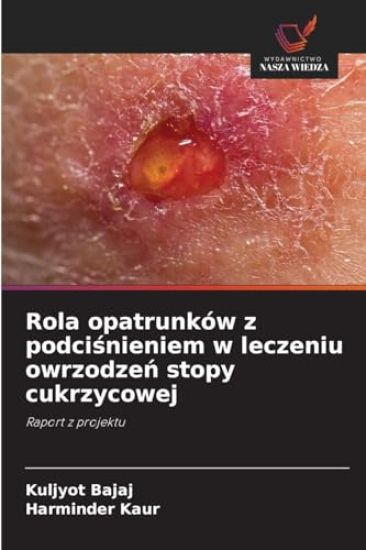 Rola opatrunków z podcisnieniem w leczeniu owrzodzen stopy cukrzycowej