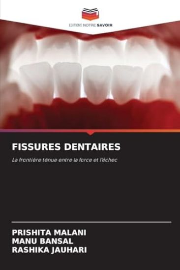 Fissures Dentaires