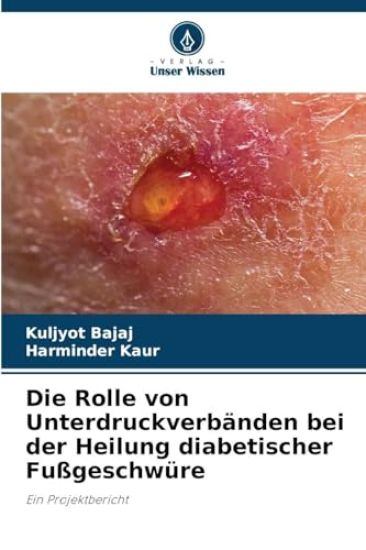 Die Rolle von Unterdruckverbänden bei der Heilung diabetischer Fußgeschwüre
