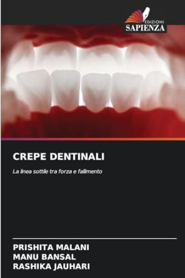 Crepe Dentinali