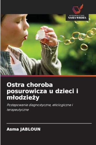 Ostra choroba posurowicza u dzieci i mlodziezy