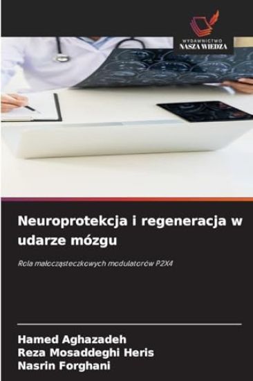 Neuroprotekcja i regeneracja w udarze mózgu