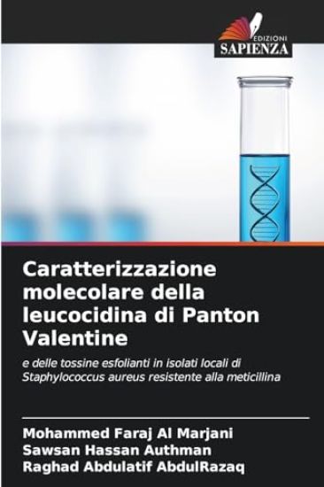 Caratterizzazione molecolare della leucocidina di Panton Valentine